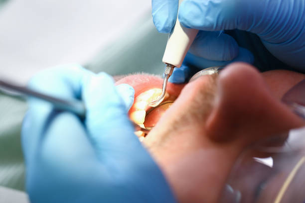 Best Urgent Care for Lost Fillings or Crowns in Baldwinville, MA