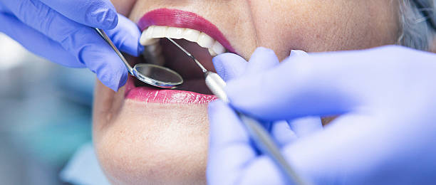 Best Emergency Root Canal Treatment in Baldwinville, MA